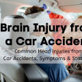 Understanding the Link Between Car Accidents and Traumatic Brain Injuries